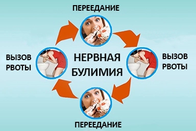 Лечение булимии в Красногорском